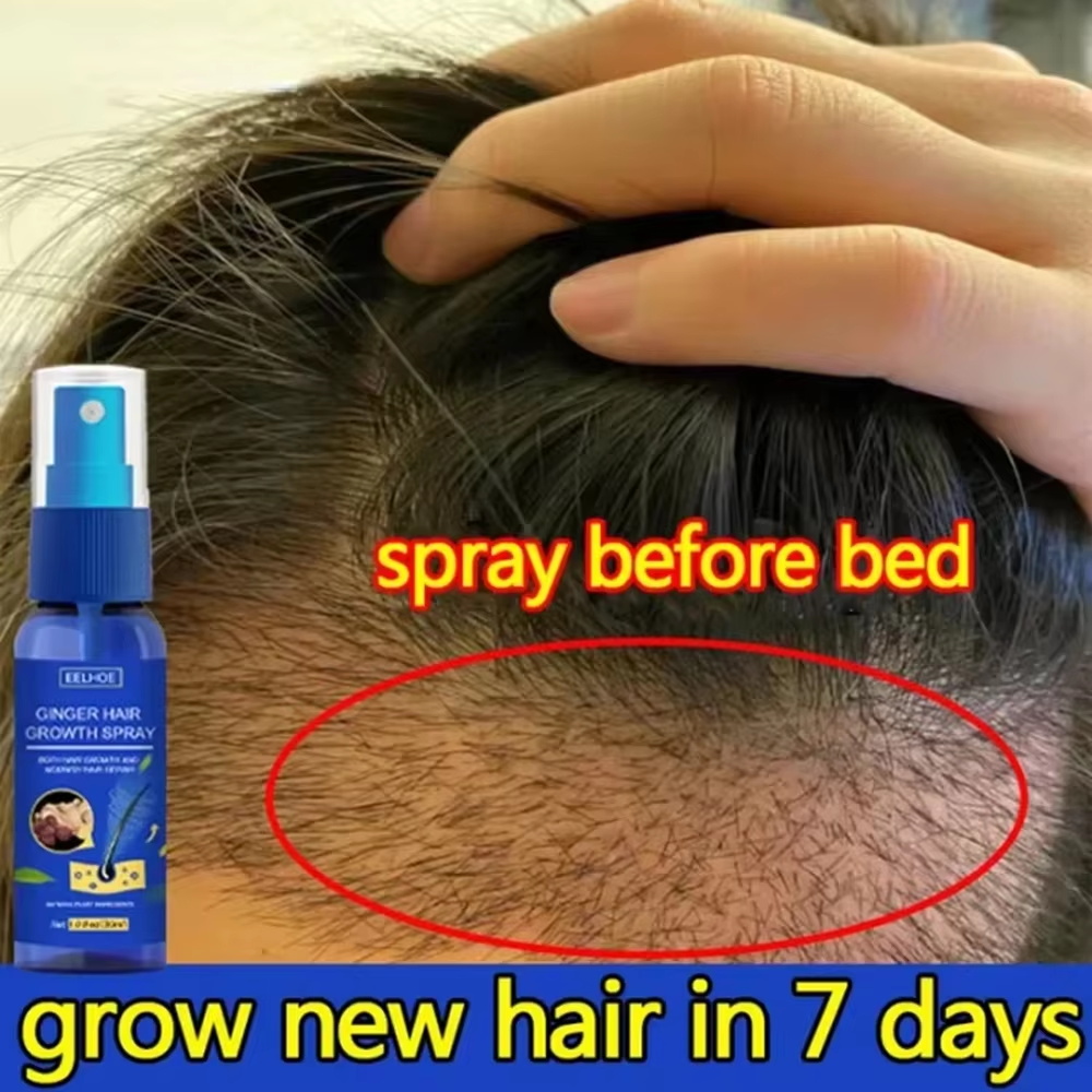 Growth Factor Serum - 빠른 생강 모발 성장 스프레이, 모발