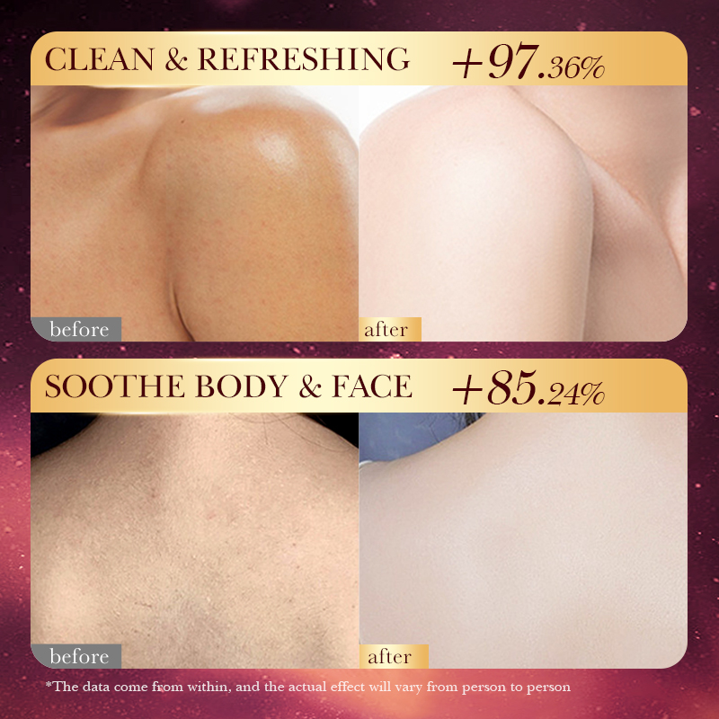 로즈 골드 포일 수제 비누 – 천연 에센셜 오일 보습  - Luxury Skincare Essential 리뷰 및 가격