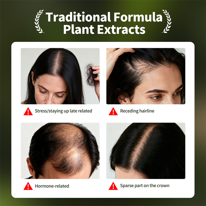 자연 모발 성장 세트 우스만 허브 샴푸 비누 허브 모발 - Growth Factor Serum 리뷰 및 가격